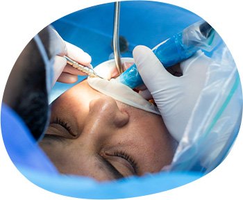 Cirugía maxilofacial