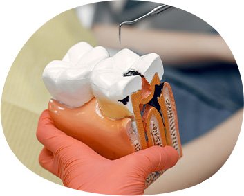 Endodoncia