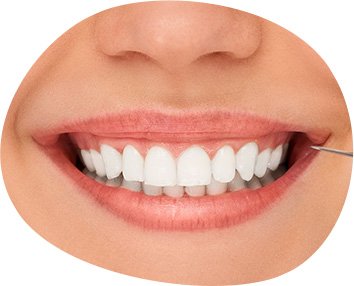 Odontología estética
